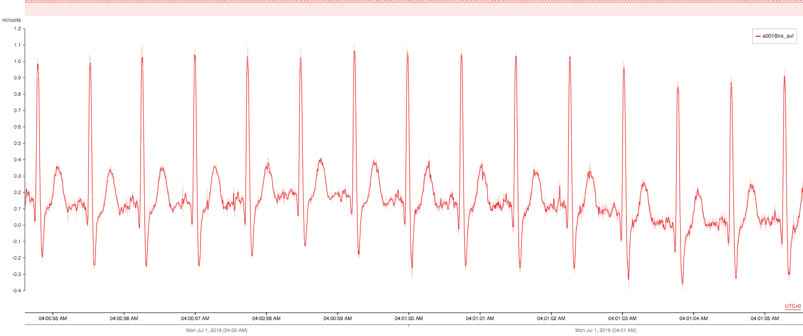 EKG Data